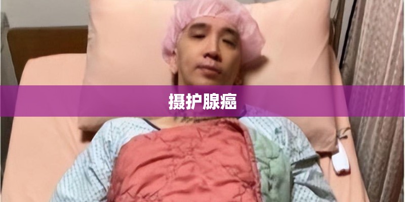 摄护腺癌