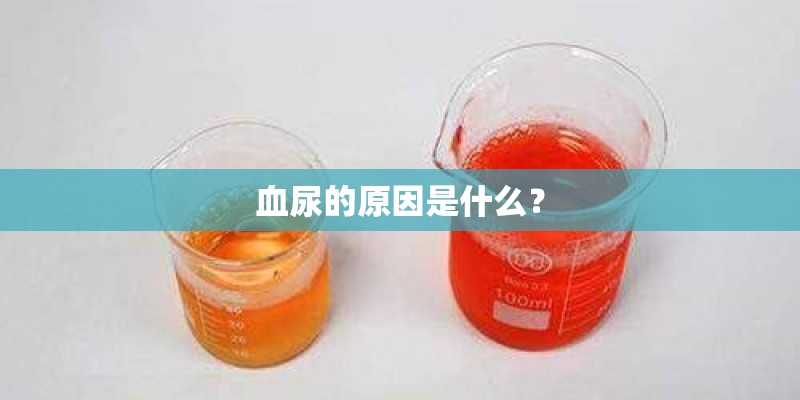 血尿的原因是什么？